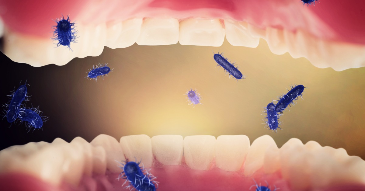 Bakterija Streptococcus pyogenes – uzročnik gnojne angine