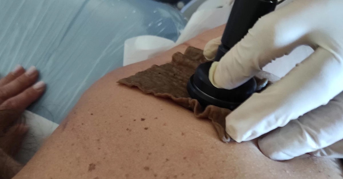 terapija za bol u leđima