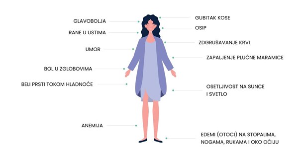 infografik simptoma lupusa kod žena